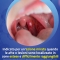 Oral Spray For Treatment Of Mouth Ulcers For Children Too 200 ml