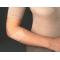 steristrip suture plaster 6x75mm + 3x75mm