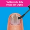 Excilor Forte - For the treatment of mycosis on the nail 30 ml