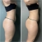FIR - Anti-cellulite treatment 1kg + cream 200 ml