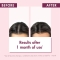 Shampoo With Quinine And Edelweiss Bio Hair Loss 400 ml