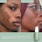 Vinopure - Anti-imperfections salicylic serum 30 ml