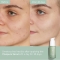 Vinopure - Anti-imperfections salicylic serum 30 ml