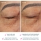 Bear - Anti-aging device - fuchsia