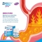 Gastro Activ - medical device for reflux