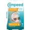 7 Stop-Pimple Cleansing Patches