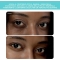 Iris 2 Mint - Eye masseur