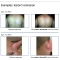 Bioactive Gel - Medical Device For Psoriasis 100 Ml
