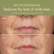 Plantscription Active Wrinkle Correction Serum 30 ml