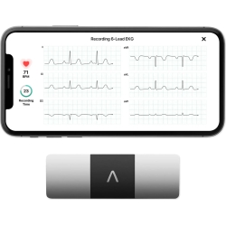 Kardia mobile 6L - elettrocardiogramma portatile