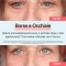 Dark Circles Eye Bags 8 ml