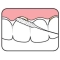 Bridge & Implant Floss - 30 dental floss for implants and bridges