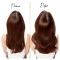 3-in-1 anti-dandruff Shampoo 225 ml