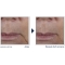 Multi Correxion Firm + Lift Firming Face Cream 50 ml