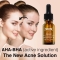 Shot Concentrato Aha + Bha - Exfoliating face serum 15 ml