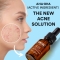 Shot Concentrato Aha + Bha - Exfoliating face serum 15 ml