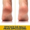 Calluses - Exfoliating and Smoothing Pumice Cream for Feet and Legs 100 ml