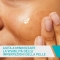 Acne Control Gel 40 Ml