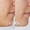 Vinopure Anti-Pore Purifying Cleansing Gel 150 ml