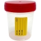Sterile container for urine collection